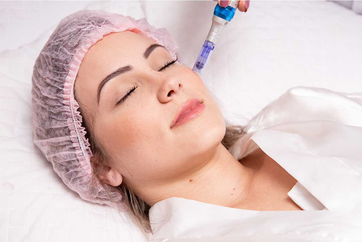 Microneedling Wien, Microneedling Wien 1220, Schönheitssalon 1220 Wien