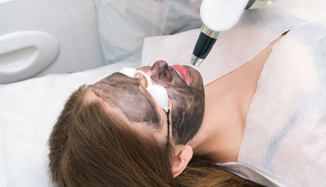 Carbon Gesichtsbehandlung